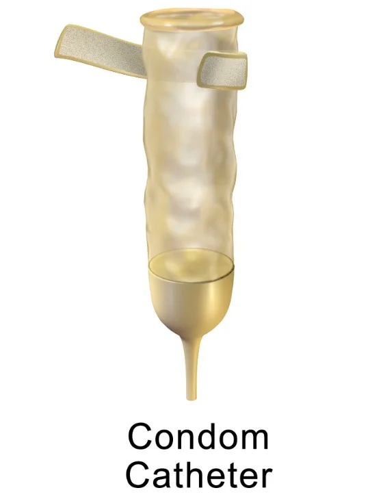 Condom Catheter